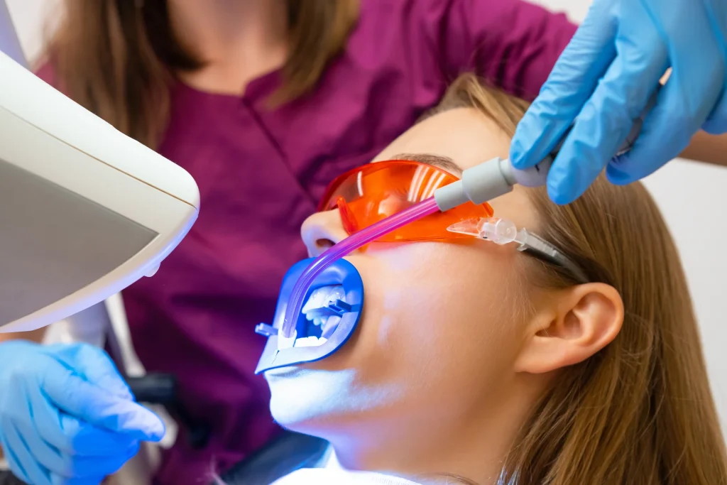 Quanto dura l’effetto dello sbiancamento dei denti