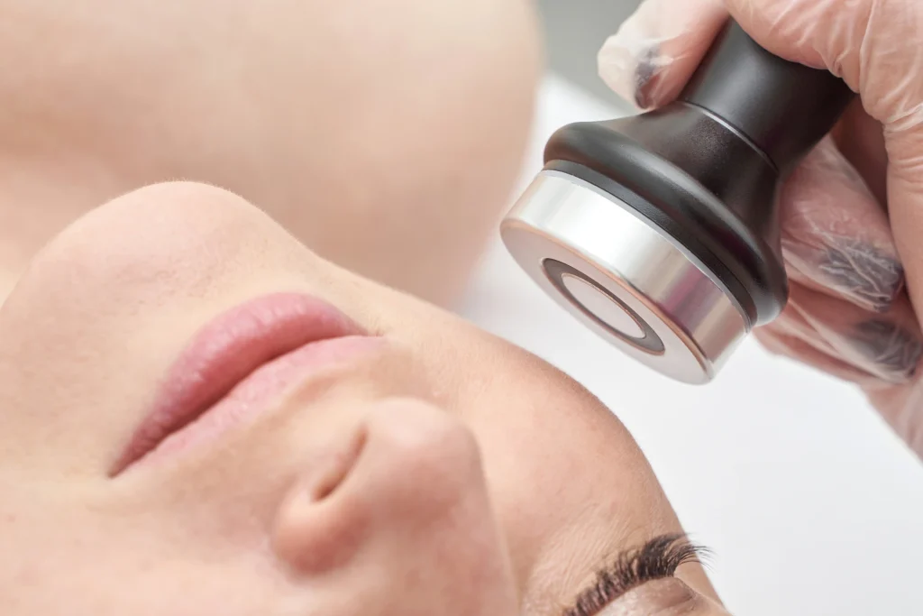 Trattamento viso con radiofrequenza